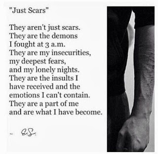 just scars